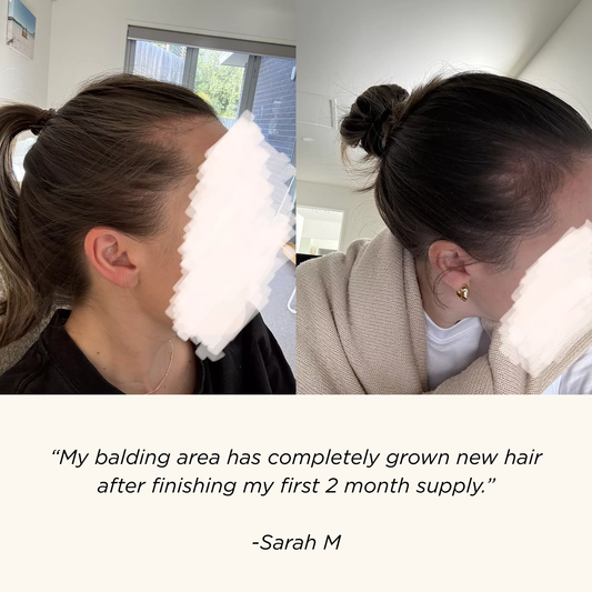 Vita-Growth Peptide Scalp Serum