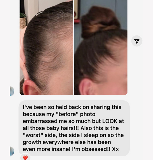 Vita-Growth Peptide Scalp Serum