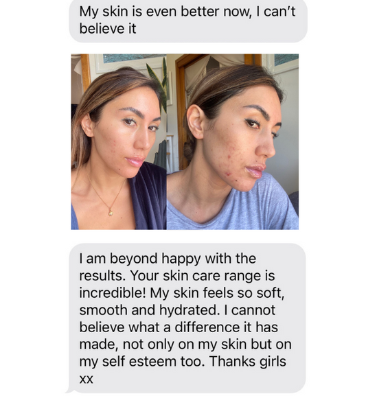 Probiotic Vitamin Moisturiser